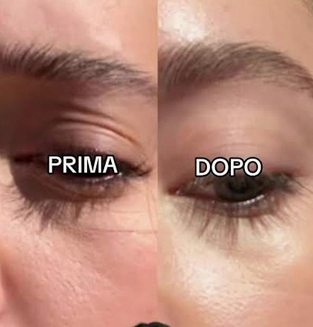 Immagine prima-dopo trattamento viso coreano 1